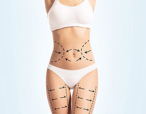 Lipo Cavitation in Alpharetta, GA