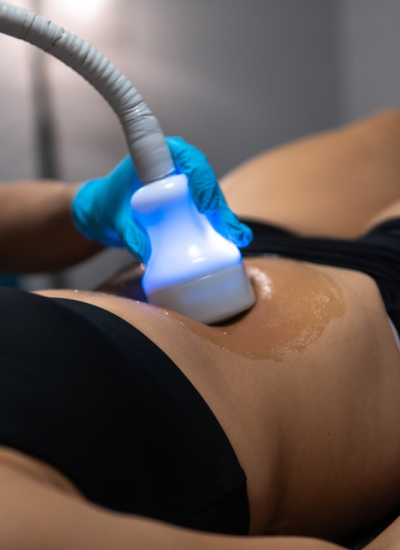 cryoskin treatment alpharetta ga