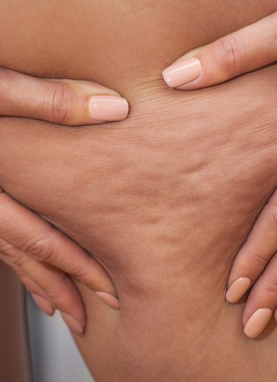 AdobeStock_120735687(1) 1